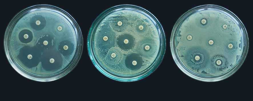 CEO Mampu  Menghambat  Pertumbuhan Biofilm