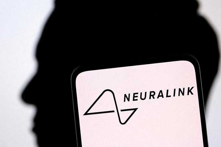 Implan Otak dari Neuralink Dapat Menggerakkan Mouse Komputer dengan Pikiran