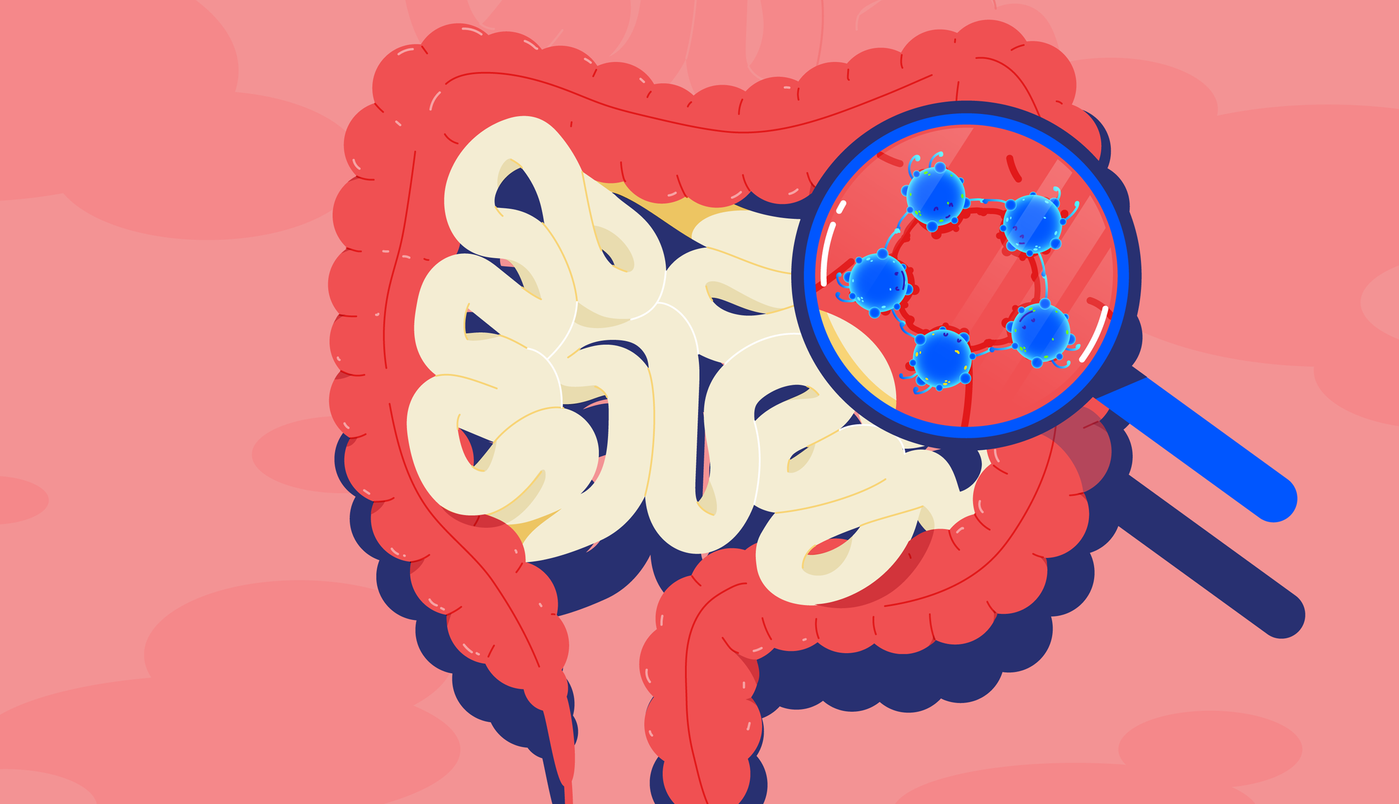 Mengenal Dysbiosis, Kondisi Ketidakseimbangan Spesies Bakteri dalam Tubuh