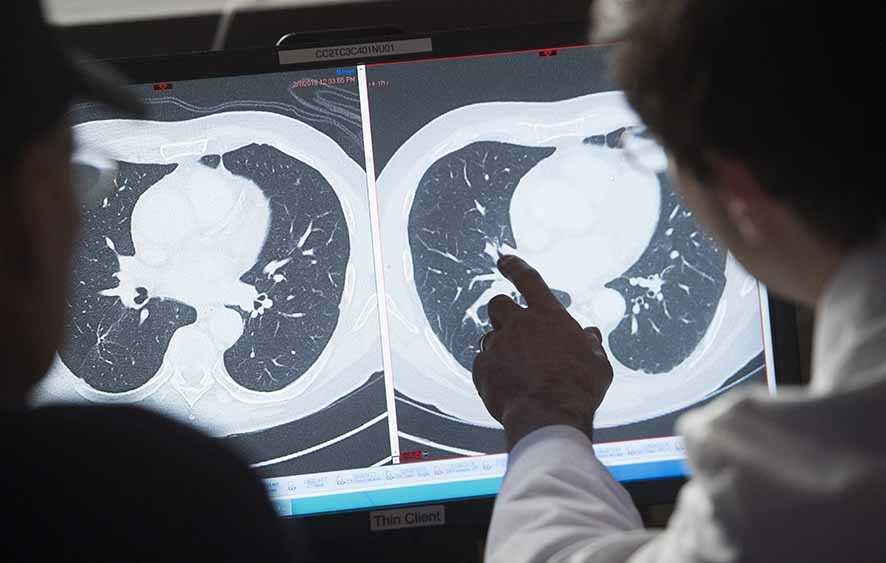 Pengeditan Dasar Sel-T  Sembuhkan Leukemia