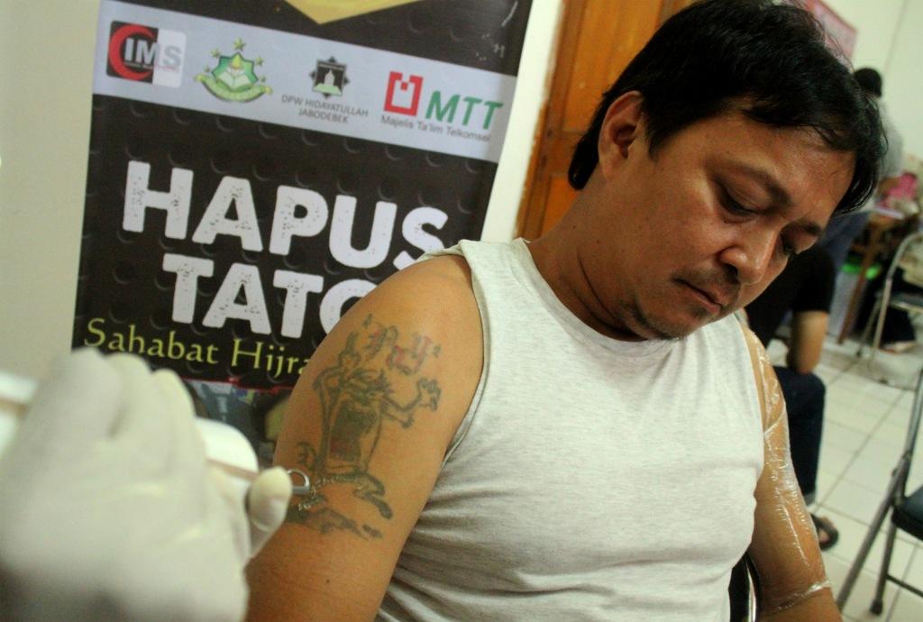Penghapusan Tato