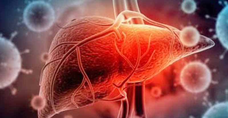 Apa Itu Hepatitis? Ayo! Kenali Penyebab dan Cara Mencegahnya 