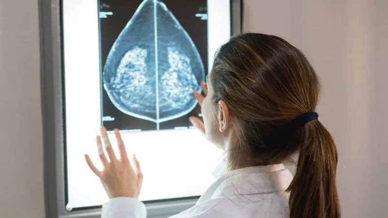 Uji Coba Pertama di Dunia, AI Membantu Dokter Mendeteksi Kanker Payudara 