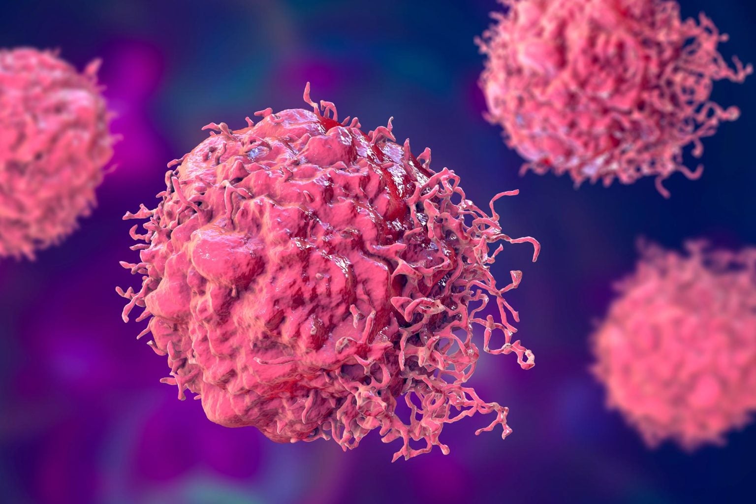 Ilmuwan Temukan Sel Imun yang Seharusnya Melawan Kanker Diam-diam Justru Membantu Pertumbuhan Tumor
