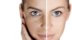 Ini Rahasia Hilangkan Kerutan dan Flek Hitam Akibat Photoaging