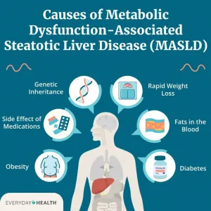Studi Menunjukkan Hampir 2 Miliar Orang akan Terkena Penyakit Hati Metabolik pada Tahun 2050