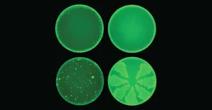 MRSA, Bakteri Kebal Antibiotik yang Jadi Ancaman Dunia Medis