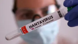Dinkes: Suspek Hantavirus di Kulon Progo Dipastikan Negatif