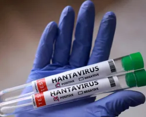 Spanyol Laporkan Kasus Hantavirus Baru, Total Menjadi 11 Kasus