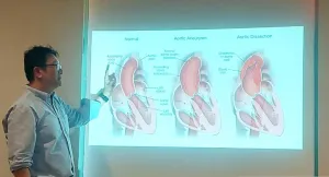Kata Dokter, Nyeri Dada Seperti Ditusuk Tanda Ada Robekan Dinding Aorta