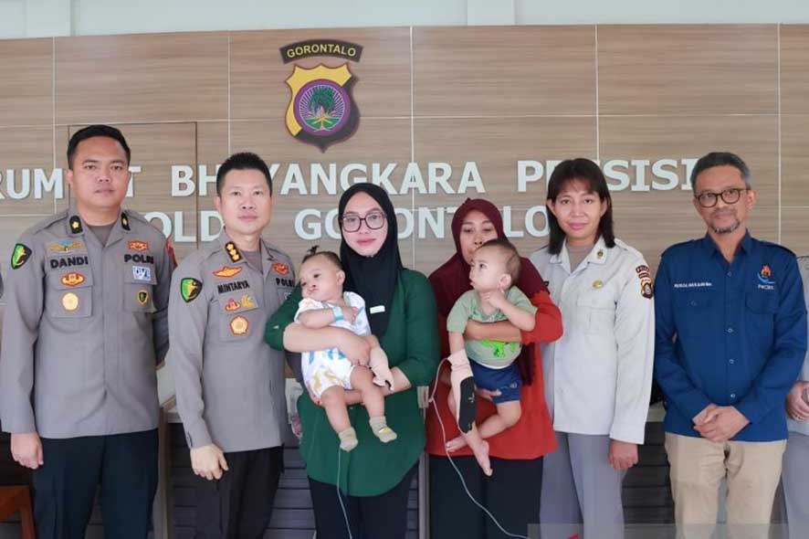 Gelaran Operasi Bibir Sumbing bagi 20 Anak
