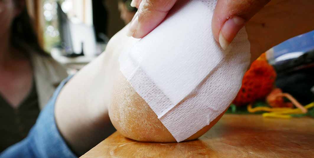 Mencari Senjata Baru Melawan Bakteri Super
