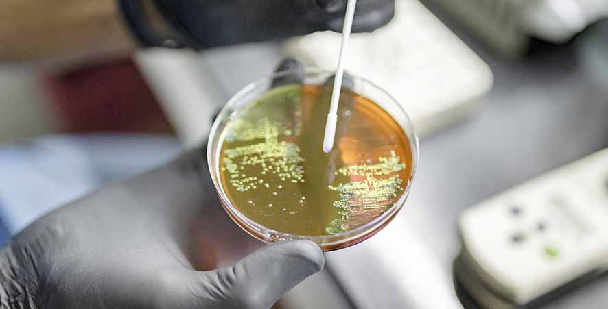 Terapi Cahaya dan Nanomaterial Harapan Baru Basmi Bakteri...