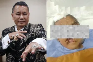 Kontroversi Kasus YTR Memanas! Hotman Paris Serang Pernyataan Komnas Perempuan, Minta DPR dan Presiden Bertindak