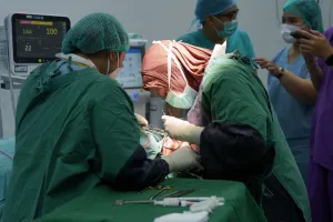 WINGS Peduli Fasilitasi Operasi Bibir Sumbing Gratis bagi 20 Anak di Jawa Timur