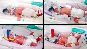 Fenomena Langka, Empat Bayi...