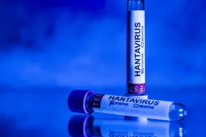 Hantavirus Kembali ke Permukaan, Tewaskan 3 Korban Jiwa di Venezuela
