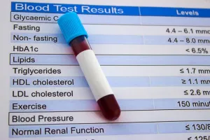 Waspada! Kolesterol Tinggi Umumnya Tak Bergejala, Dokter Anjurkan Cek Rutin!