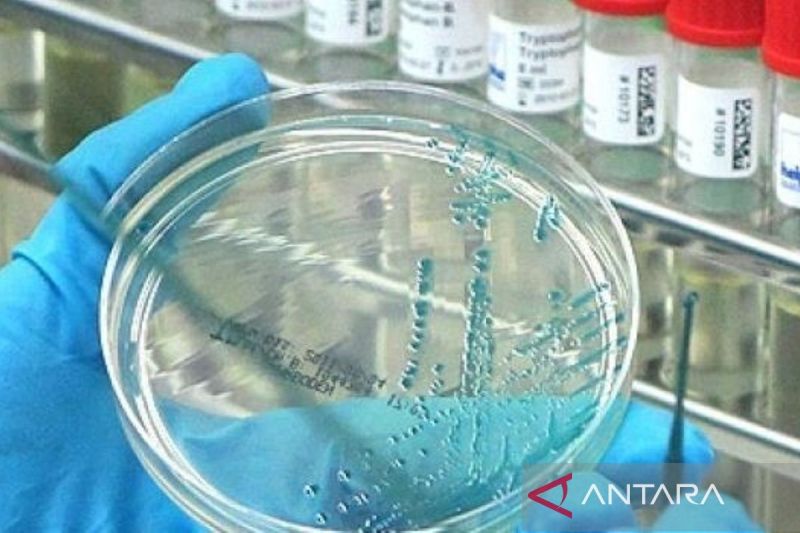 Semoga Tidak Menular ke Indonesia, Australia Konfirmasi K...