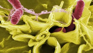 Wabah Salmonella akibat Cabai Jalapeno Menyerang di 27 Negara Bagian AS, 345 Orang Jatuh Sakit