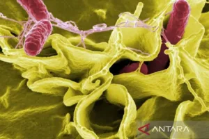 Waspadai Penyakit Menular Ini, Wabah Salmonella Akibat Jalapeno Menyebar ke 27 Negara Bagian AS