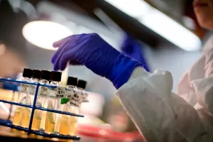 Ilmuwan Stanford Gunakan AI untuk Membuat Virus Baru yang Dapat Membunuh E.Coli 