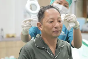 Transplantasi Rambut Dilakukan secara Bertahap Sesuai Kondisi Donor