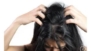 Ketombe Ganggu Aktivitas Keseharian Anda? Simak Cara Menghilangkannya