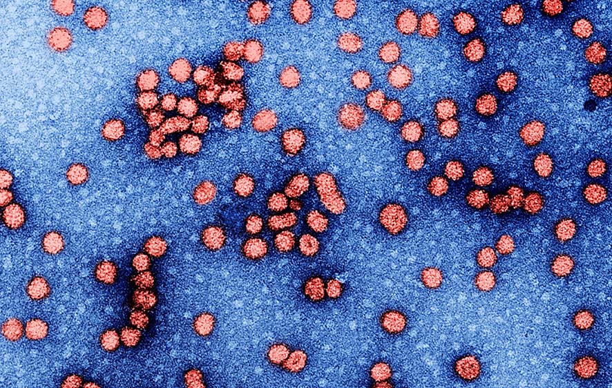 Virus Bandel yang Tinggalkan Jejak di Sel