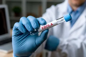 Wabah Ebola Tewaskan Lebih dari 4.000 Warga di Kongo