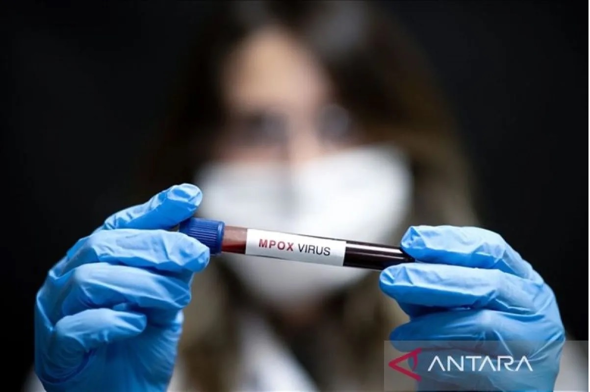Pria 61 Tahun Meninggal Akibat Penyakit Mpox di Spanyol