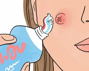 Benarkah Pasta Gigi Bisa Me...