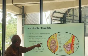 Kenali Perubahan pada Payudara untuk Cegah Terkena Kanker