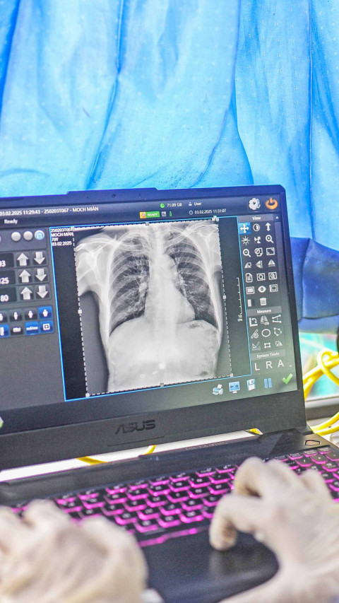 Layanan Keliling Deteksi Tuberkulosis